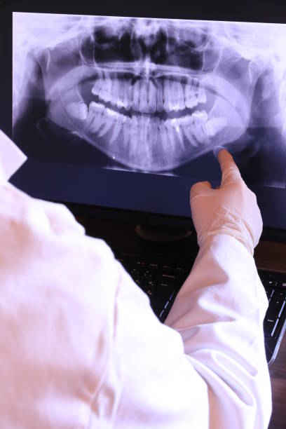Best Emergency Wisdom Teeth Removal in Oshkosh, WI